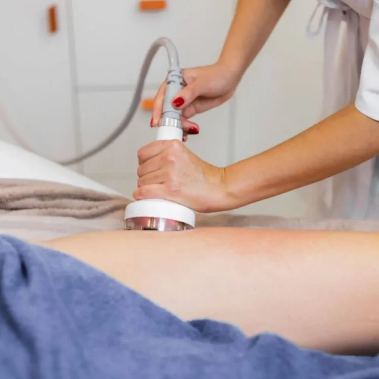 Soin minceur par Cryolipolyse à Issoire